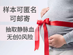 无锡匿名DNA亲子鉴定程序是什么