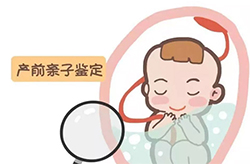 无锡如何做胎儿亲子鉴定